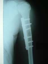 coimbatore-orthopaedic-joint-replacement-maternity-child-welfare-centre-india